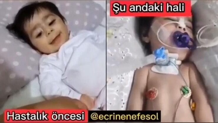 3 yaşındaki SMA hastası Ecrin bebek için kermes